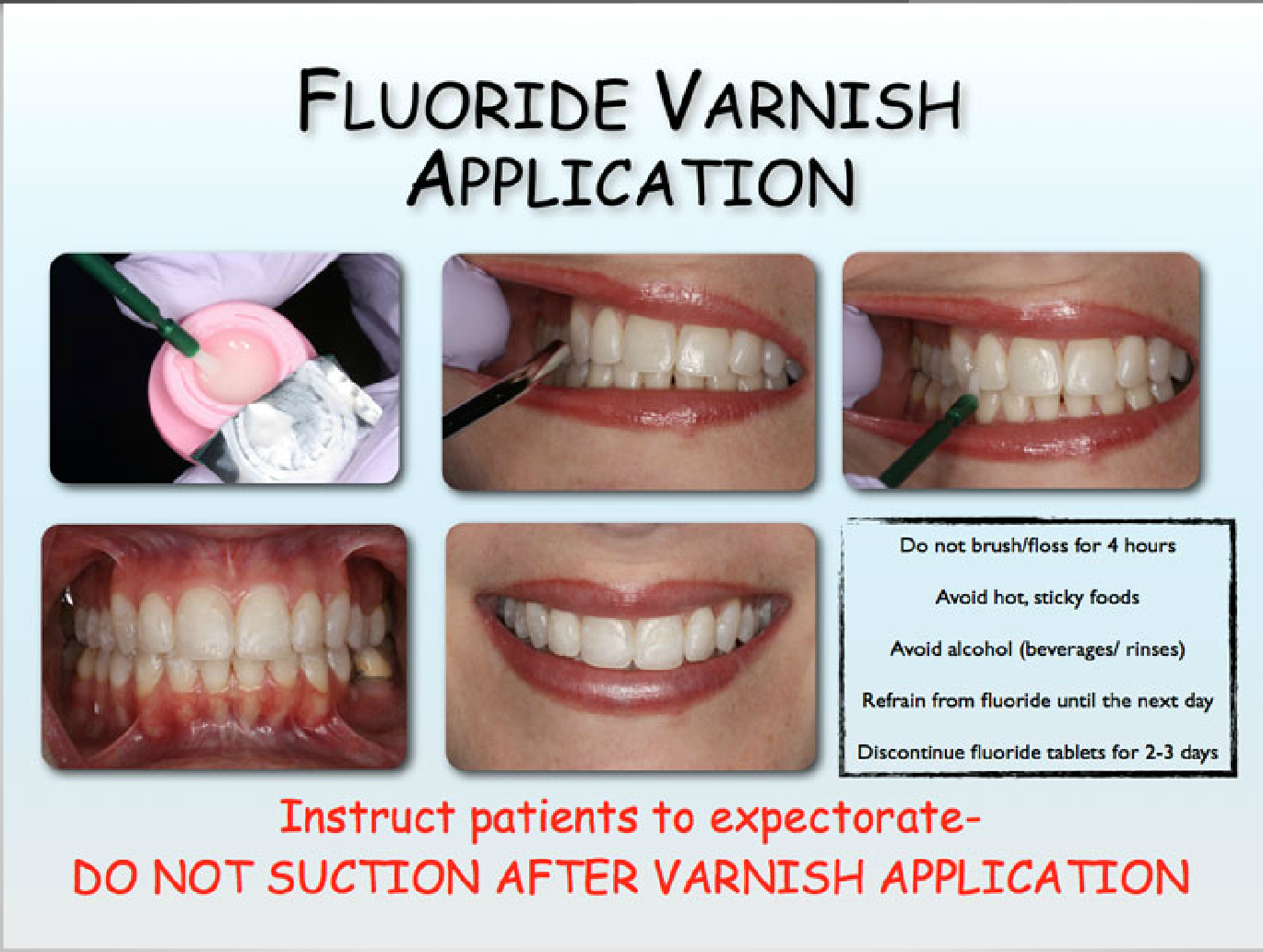 Webinar: Using Fluoride Varnish for Improved Patient Outcomes