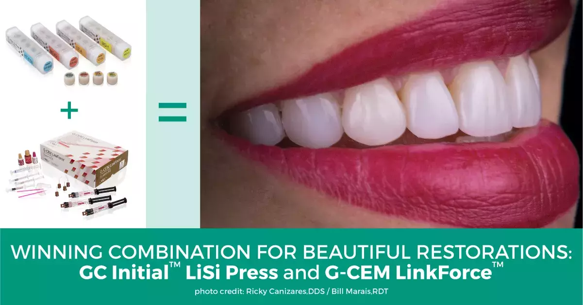For Beautiful Restorations that Last: G-CEM LinkForce® and GC Initial™ LiSi Press