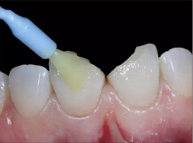 Creating natural asthetic