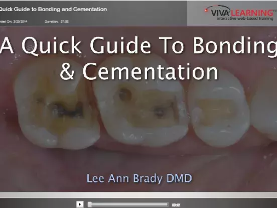 A Guide to Bonding and Cementation