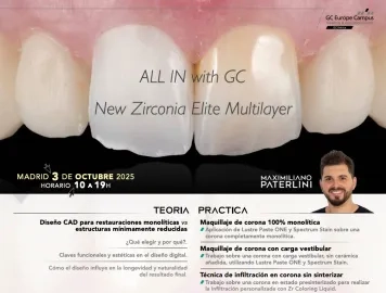 ALL IN WITH GC