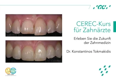 CEREC-Kurs für Zahnärzte