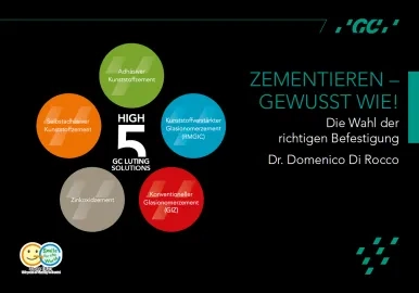 Zementieren Di Rocco