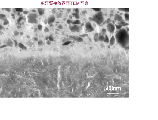 象牙質接着界面TEM写真