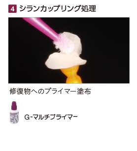 シランカップリング処理