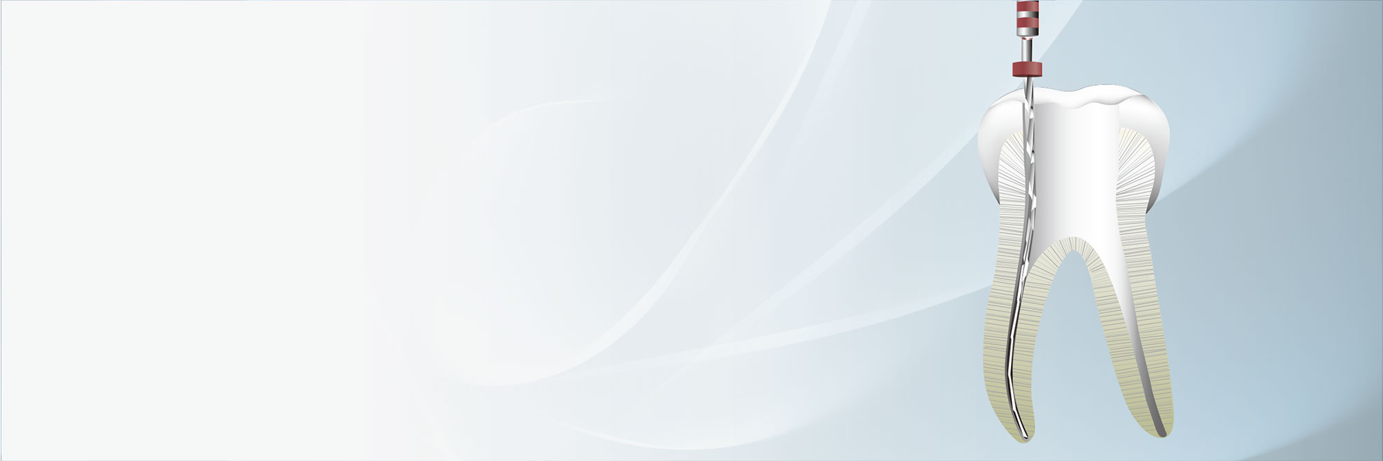 切削効率と柔軟性のバランスを考慮したNiTi ロータリーファイル NEX NiTiファイル