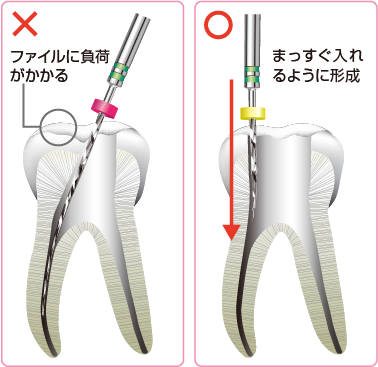 ×ファイルに負荷がかかる、○まっすぐ入れるように形成