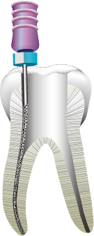 ネゴシエーション