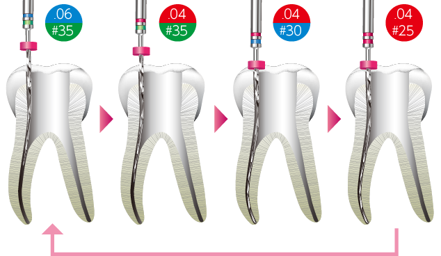 Aセット クラウンダウン法