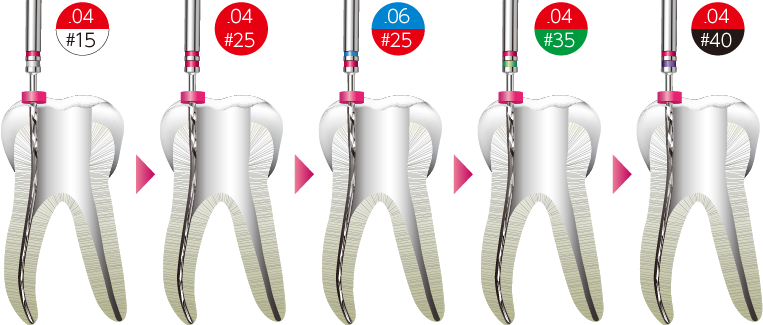 Bセット フルレングステクニック