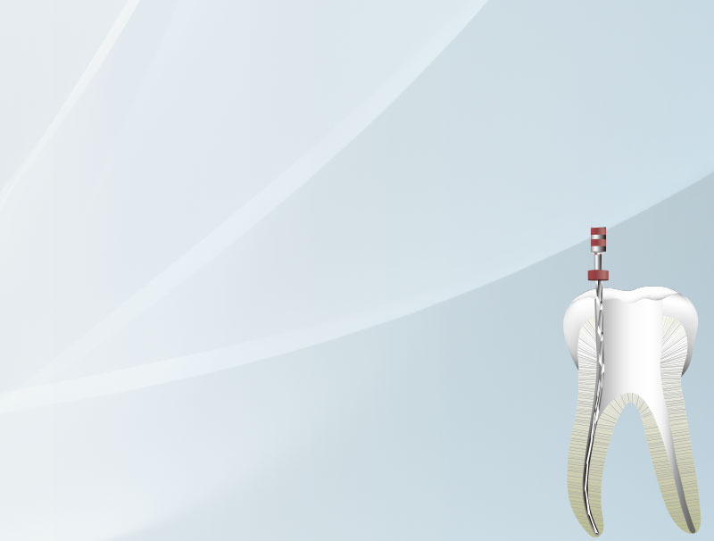 柔らかくしなやかに 曲がる 曲げる もどる NEX NiTi ファイル Ms 形状記憶M相 NiTiロータリーファイル