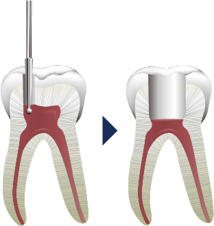 アクセス〜アウトライン