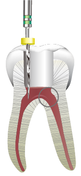 ストレートラインアクセス