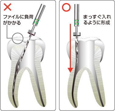×ファイルに負荷がかかる、○まっすぐ入れるように形成
