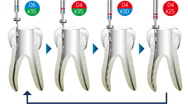 Aセット クラウンダウン法