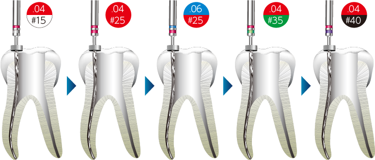 Bセット フルレングステクニック