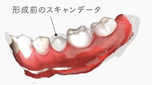 形成前のスキャンデータ
