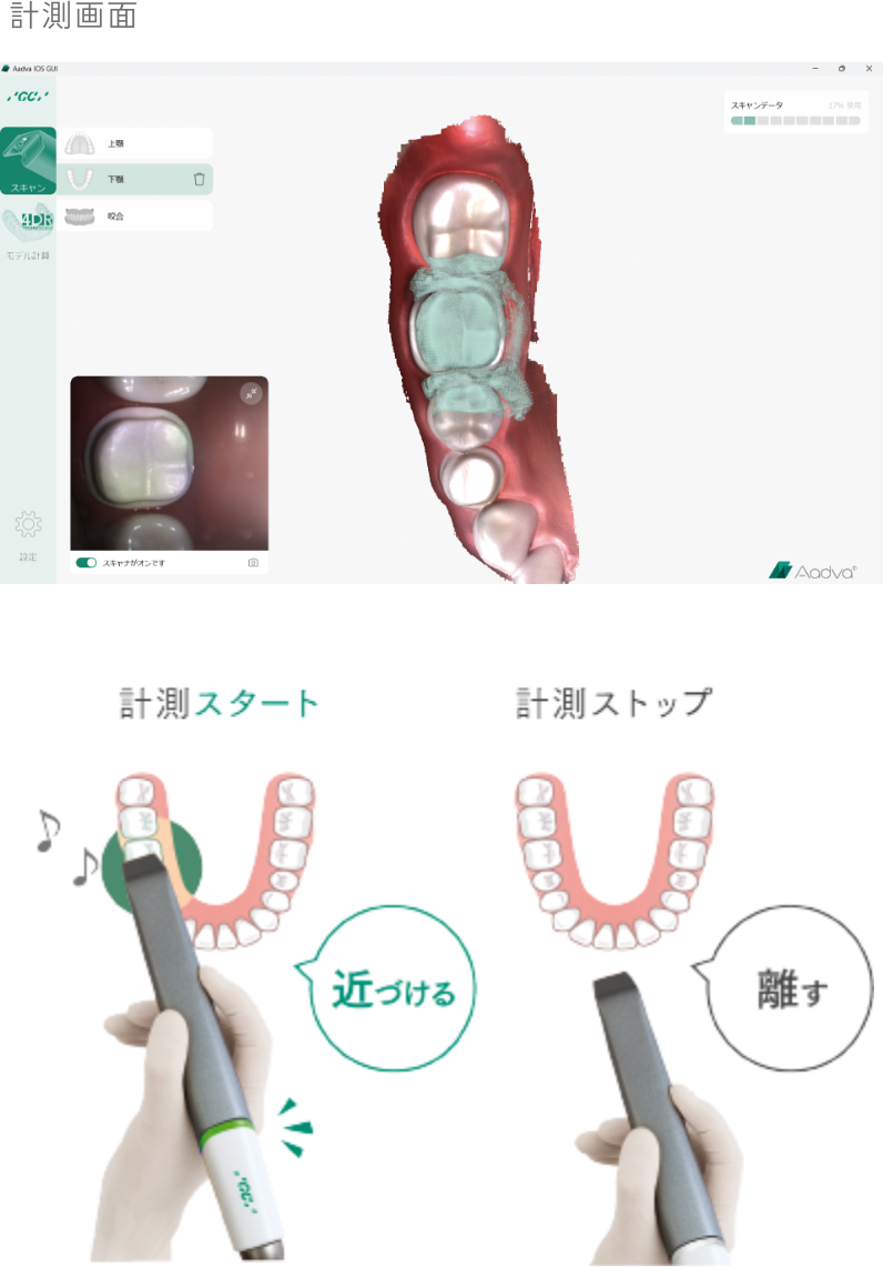 Aadva IOS 200｜株式会社ジーシー