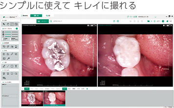 シンプルに使えて キレイに撮れる