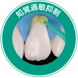 知覚過敏抑制