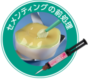 セメンティングの前処理
