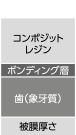 各エアーブロー条件下の被膜厚さ（SEM 画像 x1000）