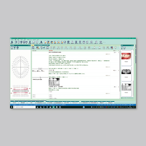 Gネクサス カルテIII