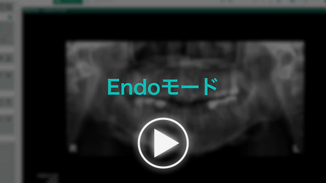 動画：Aadva Station／Endoモードのサムネイル