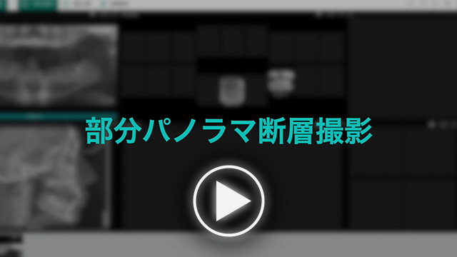 動画：Aadva Station／部分パノラマ断層撮影のサムネイル