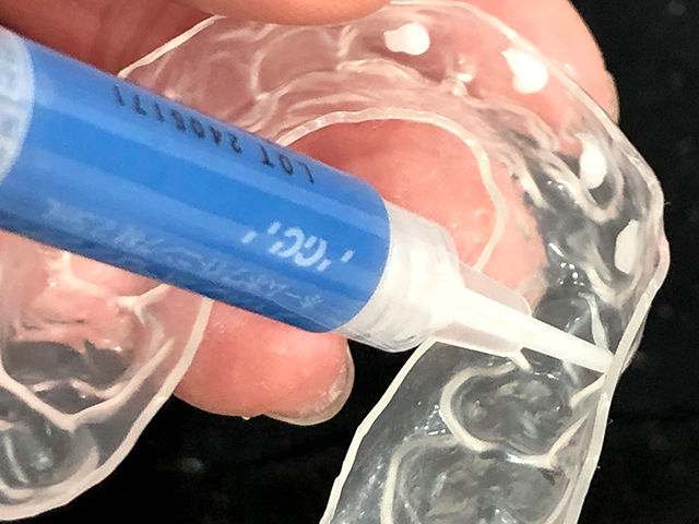 ホワイトニング中