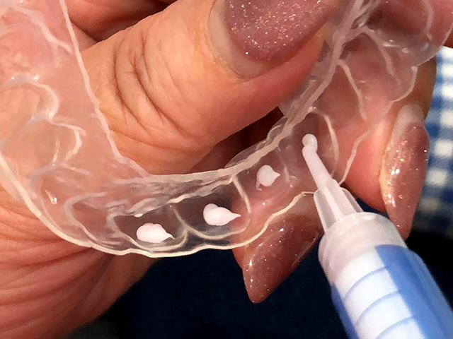 ホワイトニング前