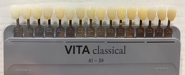 シェードガイド