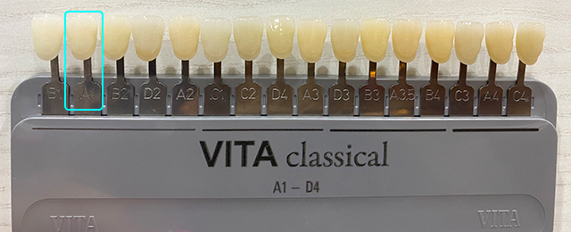 シェードガイド