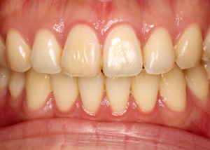 黄色系統の色調