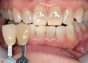 灰色系統の色調