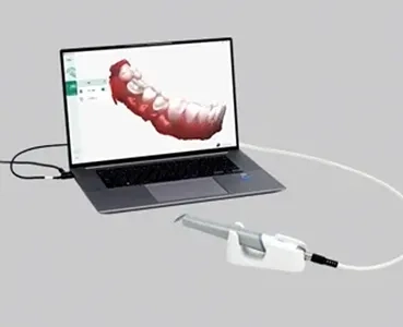 Aadva IOS 200 デジタル印象採得装置