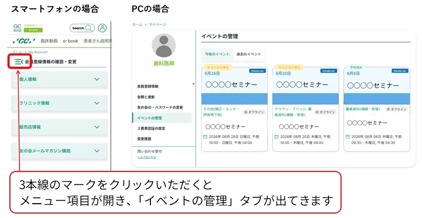 イベントの管理