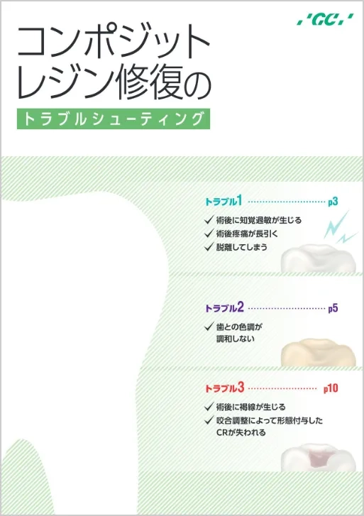コンポジットレジン修復の トラブルシューティング
