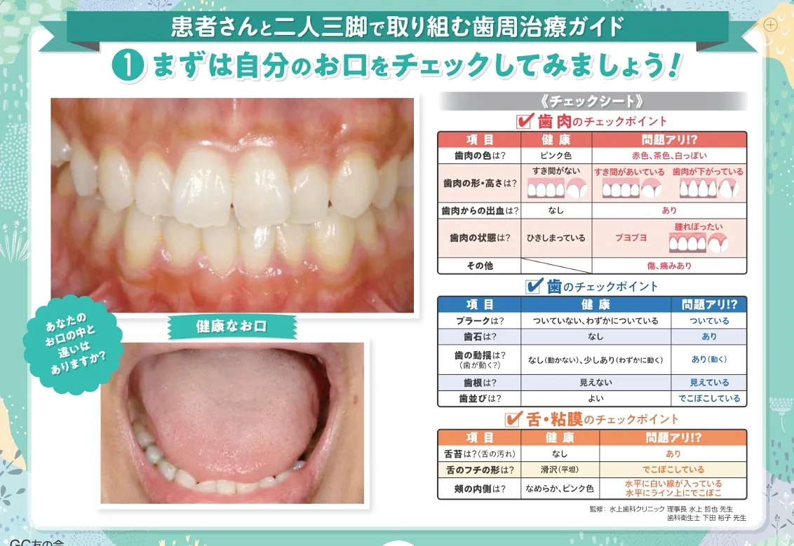 【体験版】患者さんと二人三脚で取り組む歯周治療ガイド／ 患者さん説明の極意