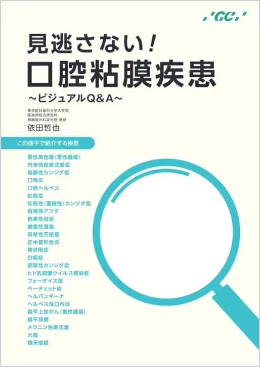 見逃さない！口腔粘膜疾患～ビジュアルQ&A～