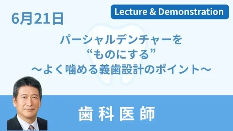 パーシャルデンチャーを“ものにする” ～よく噛める義歯設計のポイント～