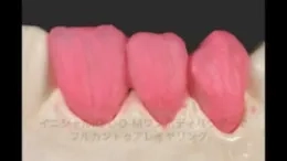 GaDt8BVb4JKFhOnbJSlHUIa3dyZiZXFXTzo2hshimOQ