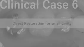 クリニカル症例6