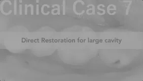 クリニカル症例7