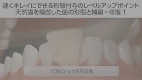 前歯部審美修復 天然歯編　歯科 体験版】速くキレイにできる形態付与のレベルアップポイント 天然歯を