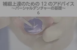 体験版】補綴上達のための12のアドバイス ～パーシャルデンチャーの基礎～