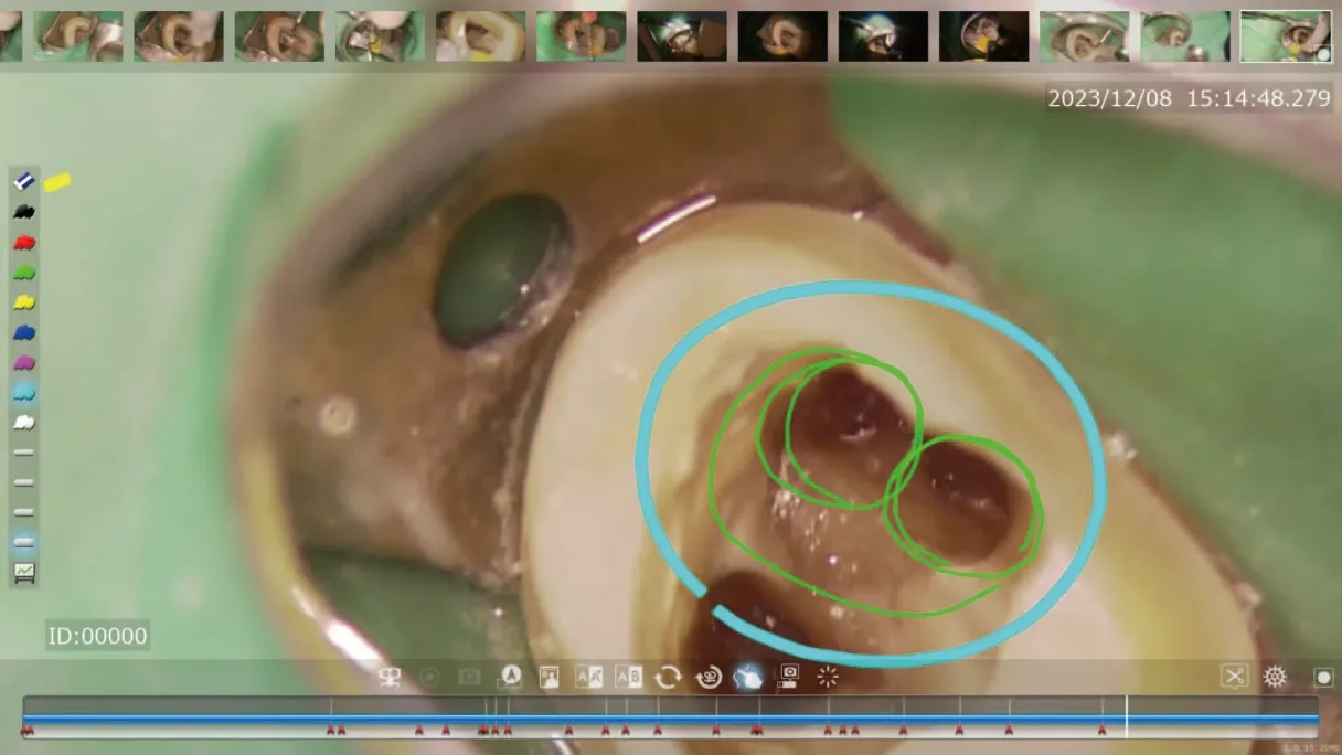 アノテーションモード