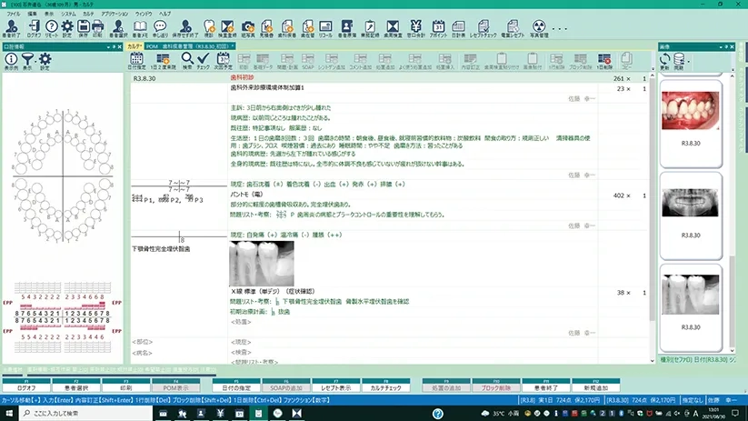 Gネクサス　カルテ３