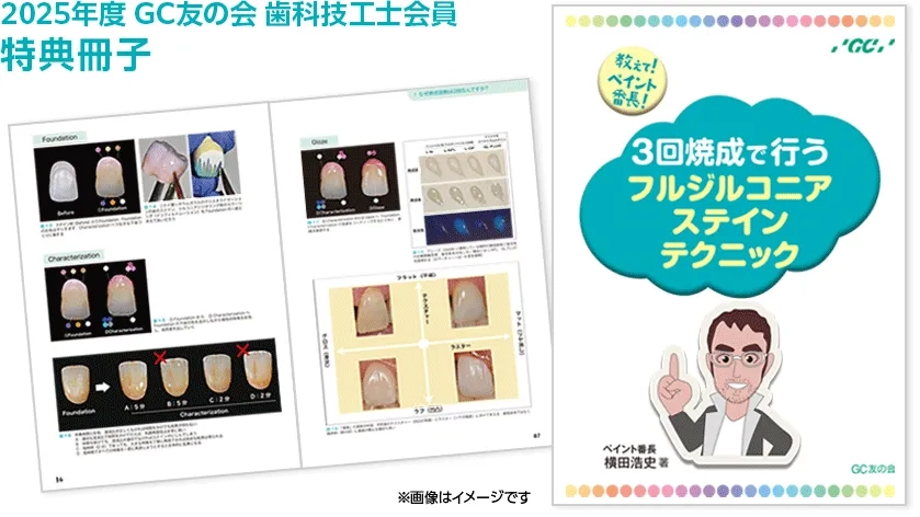 GC友の会 歯科技工士会員のご案内