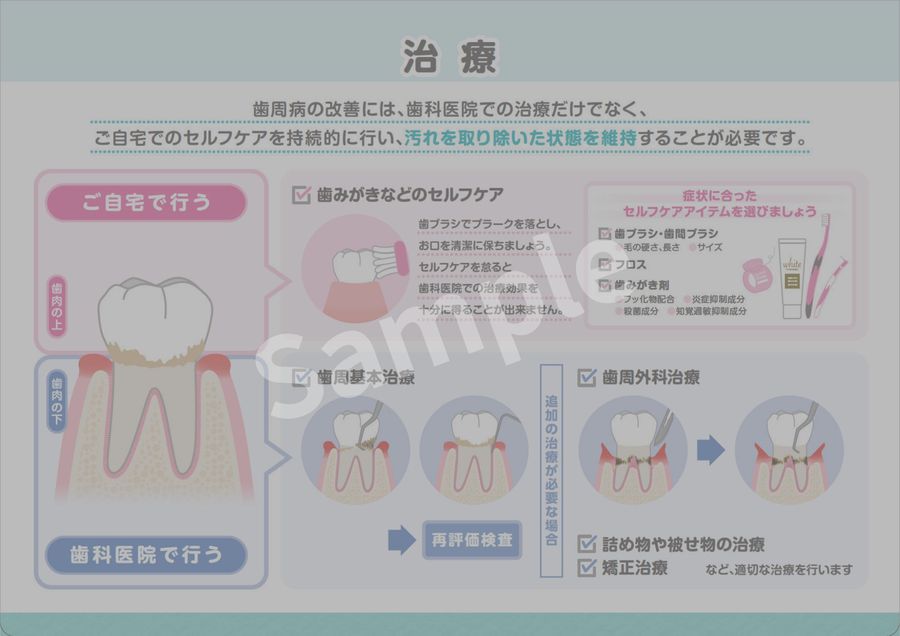体験版】歯周治療説明シート
